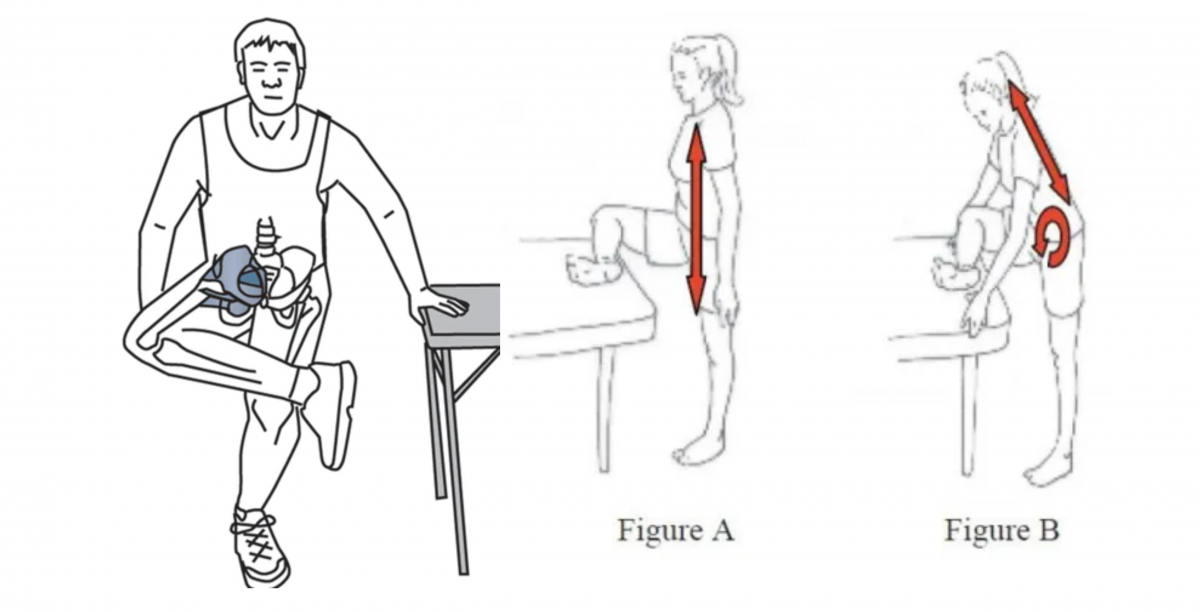 Terapi Latihan Untuk Menangani Sindrom Piriformis Fakultas Fisioterapi